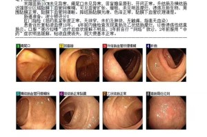 贵州新增2例本土确诊病例.贵州新增1例