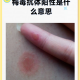 南京新增无症状感染者抗体阳性︰(南京新增一例无症状感染者抗体阳性)
