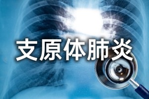 新冠肺炎的最新动态-新冠肺炎最新动态实时更新