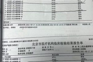 31省新增本土确诊29例-31省新增本土确诊病例1例