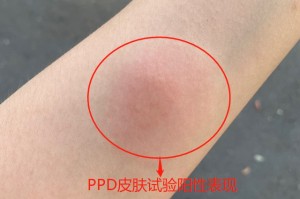 扬州1例阳性人员前10次检测均阴性.扬州 阳性