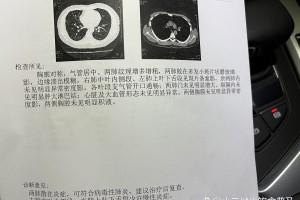「丰台新增1例境外输入」〃丰台出现一例新型肺炎
