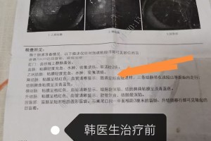 贵州新增确诊病例1例-贵州新增1例疑似病例