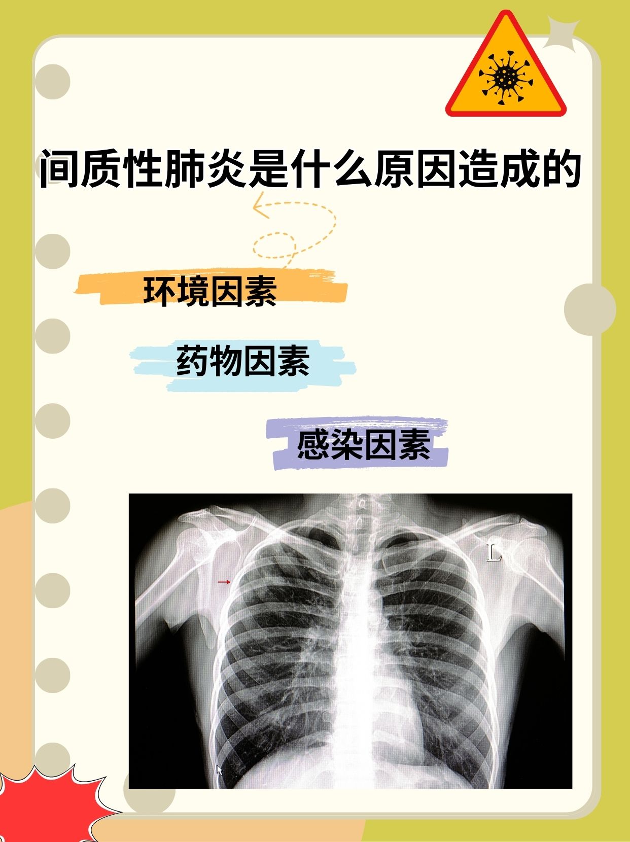 “2019年新型肺炎爆发	” 2019新型肺炎叫什么名字？-第2张图片
