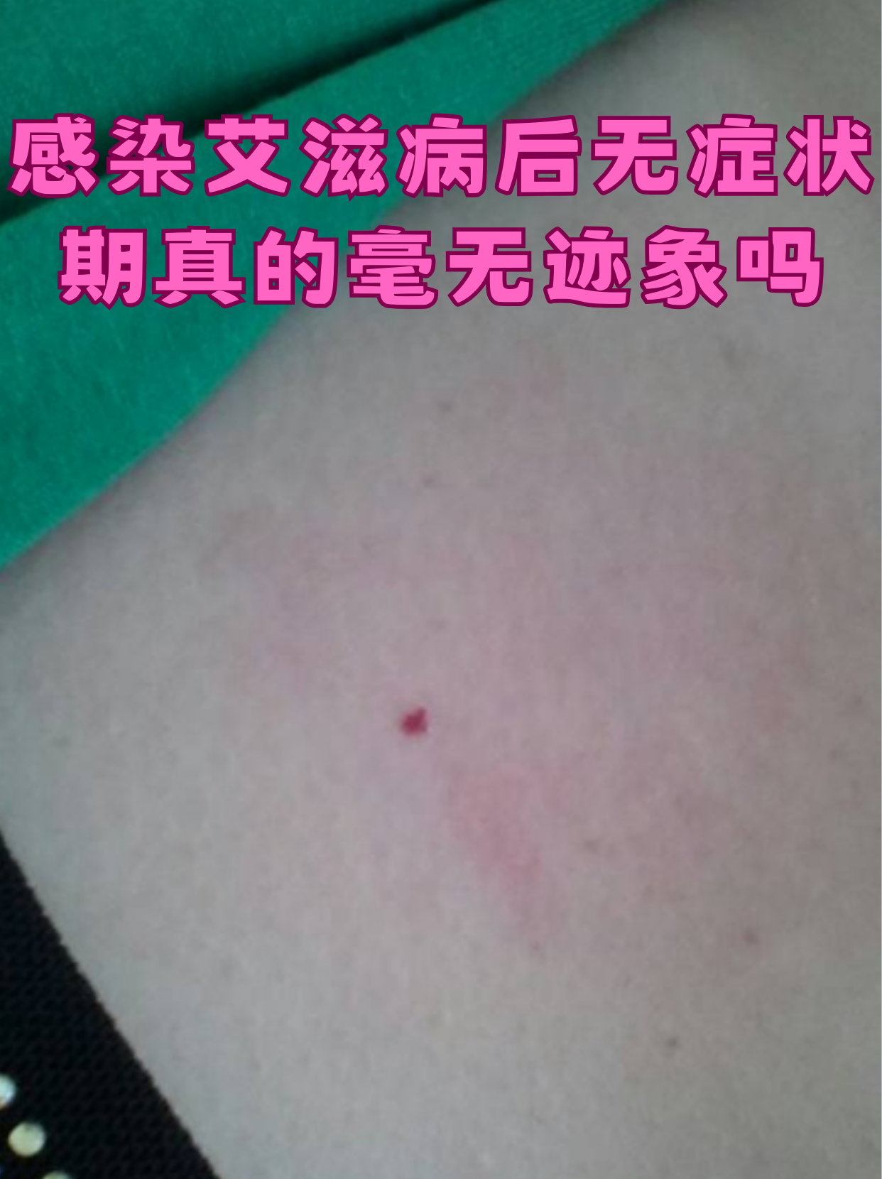 烟台发现1例无症状感染者,烟台新增1例无症状-第1张图片