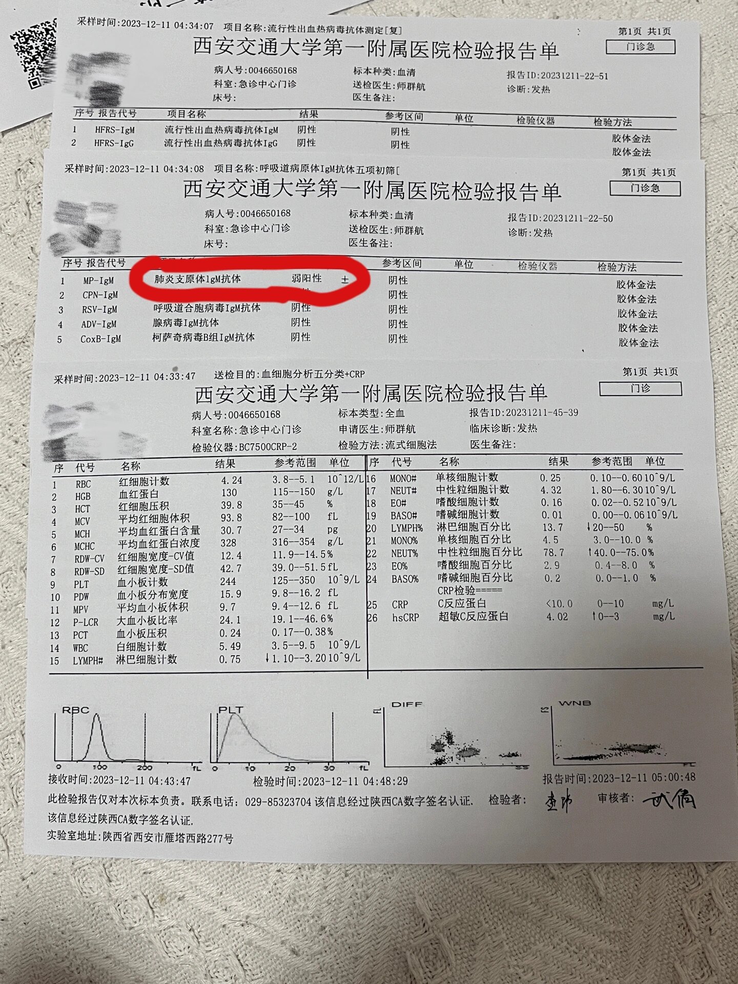 西安新增1例本土-西安新增一例确诊病例-第1张图片