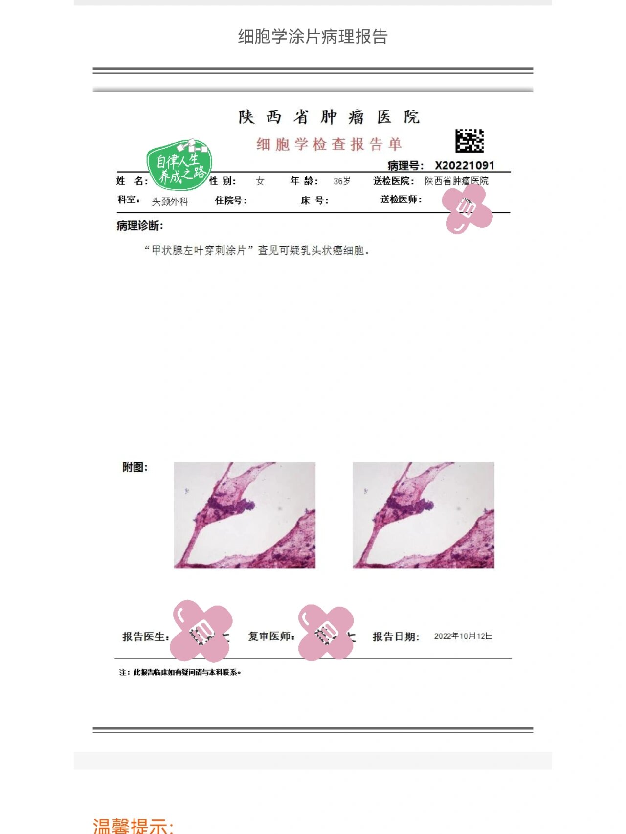 西安确诊病例最新情况︰(西安确诊病历详情)-第1张图片