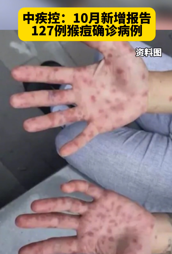 “湖北新增本土无症状11例” 湖北新增无症状感染者15例？-第1张图片